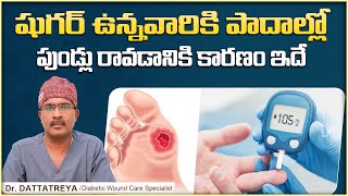 పాదాల్లో షుగర్ పుండ్లు | Signs & Symptoms of Diabetic Foot | Dr Dattatreya | Wound Care Hospitals