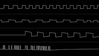 Jeroen Tel - "Closing In" (SN76489 Cover)