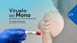 Sintomas de la Viruela del Mono (monkeypox)