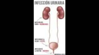 Infección de orina Síntomas, Causas y Tratamiento