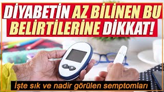 Diyabetin sık ve nadir görülen belirtileri! Diyabetin önlenmesi ve tedavisi için ne yapılmalı?