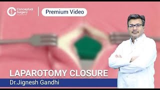 Laparotomy Closure Dr  Jignesh Gandhi