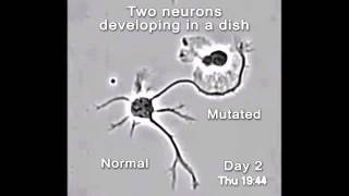 Normal & mutated neuron development