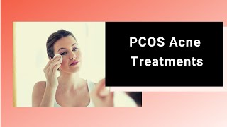 PCOS Acne Treatments