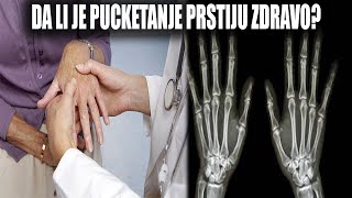 DA LI JE PUCKETANJE PRSTIJU ZDRAVO?