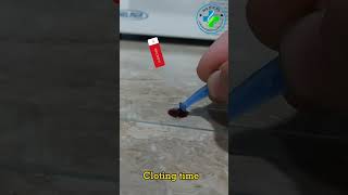 Clotting Time | Blood clotting time determination by slide method | clotting time procedure | CT