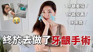 終於去做了🦷牙齦手術😭 聊聊整個過程以及我的牙齦萎縮、牙周病和牙齒發黃｜牙齒護理｜ 牙齦退縮｜小鄭杰西卡 Jessica Zheng