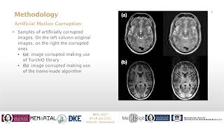 Reference-less SSIM Regression for Detection and Quantification of Motion Artefacts in Brain MRIs