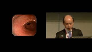 Endoscopic Resection and Outcomes, with Dr. Naohisa Yahagi, 2024 Gastric Cancer Summit