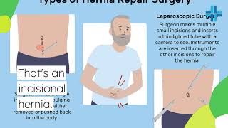 Understanding Incisional Hernias: What You Need to Know. 0777567566