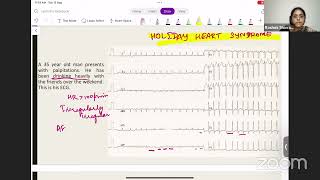 ECG - Polymorphic Atrial Tachycardia | Masterclass in Medicine | Dr Rashmi Shivram | Medusane