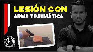 Lesion con arma traumática