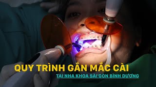 QUY TRÌNH GẮN MẮC CÀI TẠI NHA KHOA SÀI GÒN BÌNH DƯƠNG