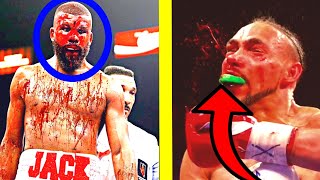 BLOODIEST Boxing Fights Of ALL TIME...