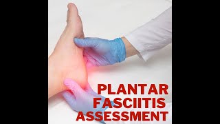 HOW TO TELL IF YOU HAVE PLANTAR FASCIITIS - The literal pain in the foot.