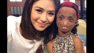 Sarah G, progeria-stricken fan in tearful meeting