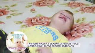 Арсену зі Скалата збирають гроші на укол, який вартує мільйони доларів. Спінальна м’язова атрофія.