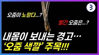 [3분만에] 소변 색깔로 건강 상태 체크하는 방법, 노란 오줌, 거품뇨, 단백뇨, 혈뇨 총정리!!