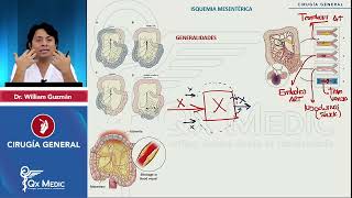 PI24   CIRUGÍA GENERAL   Abdomen agudo vascular  Isquemia intestinal aguda