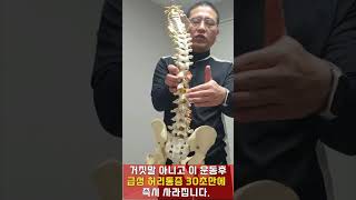 급성 허리통증 30초만에 없애는 기가막히는 효과적인 교정운동