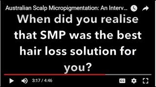 Scalp Micropigmentation, A Breakthrough in Hair Replication