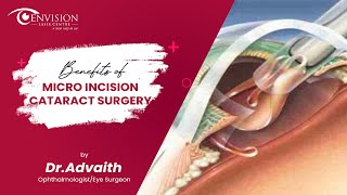 Benefits of Micro Incision Cataract Surgery | Best Eye Surgery Specialist in Hyderabad