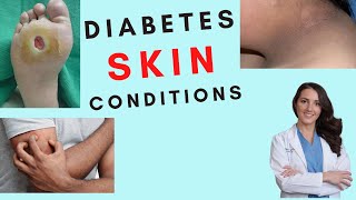 The Most Common Diabetic Skin Conditions. Skin conditions with insulin resistance.