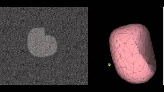 FEM simulation with corresponding ultrasound image synthesis in real time