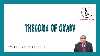 THECOMA OF OVARY  (Female Genital Tract)