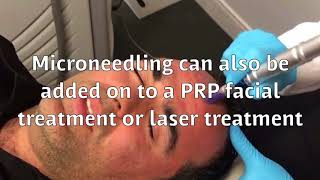 Rejuvenate the Skin with MICRONEEDLING