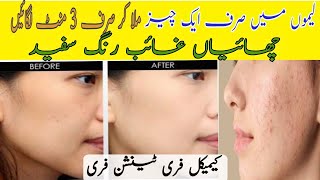 How to remove pigmentation || Fair skin||Get extra whitening , Glowing skin|in Urdu| #nbtwithsadia