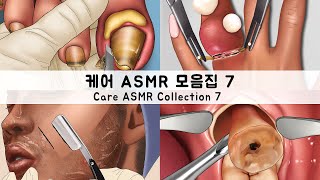 ASMR 케어 애니메이션 모음집7 내성발톱,머릿니,충치,사랑니 | CARE ANIMATION COLLECTION7 Ingrown toenails,head lice,cavities