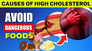 Top 11 Dangerous Foods That Are Increasing Your Cholesterol - You Should Avoid