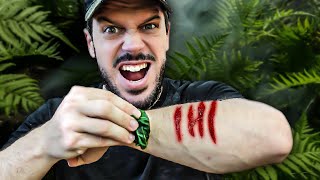 COMMENT DÉSINFECTER UNE BLESSURE EN PLEINE NATURE ? | KIT 2 MINUTES #33