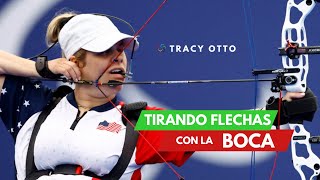 De un ATAQUE brutal a una heroína PARALÍMPICA: La historia de Tracy Otto