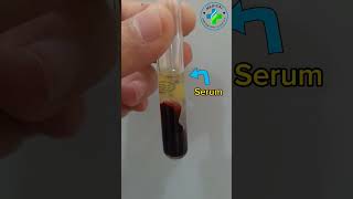 Serum | serum extraction | serum vs plasma