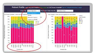 EACTS ACD Slides AM 2020