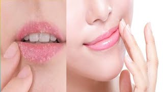 Lips Flowing Natural ।। होठों का फटना या होठों में जलन होठों का कालापन करे, Right Remedy