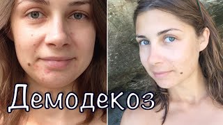 Косметика Demodex-Complex. Отзыв после 6 мес использования