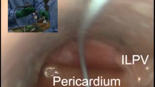 OR Convergent Procedure Educational Video