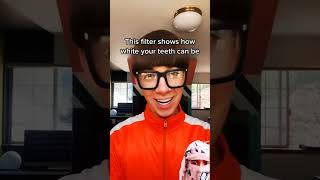 Vector's yellow teeth #comedy #funny #tiktok #memes #vector #comedymemes