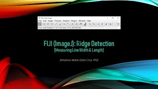 FIJI (ImageJ): Ridge Detection [Measuring Line Width & Length]