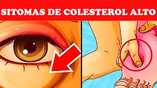 8 sintomas de colesterol alto que você nunca deve ignorar