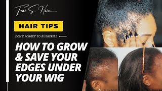 How To Grow And Save Your Edges Under A Wig