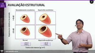 Ecocardiograma