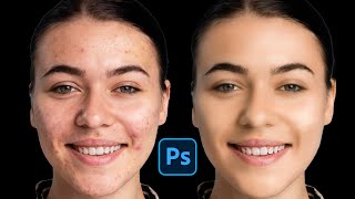 Achieve Perfect Skin in Photoshop: Advanced Retouching Tips