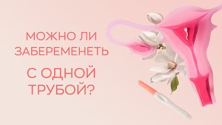 ​🔎​Можно ли забеременеть с одной трубой?