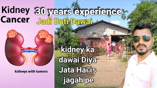 Kidney Cancer ka Dawai | 30 years experience | Tinsukiya Dangri Megala Gaon | jodi Buti Dawai