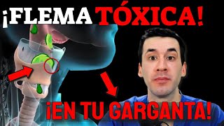 FLEMA TÓXICA en TU GARGANTA ¡ELIMÍNALA INMEDIATAMENTE!