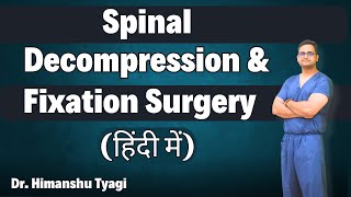 Spinal Decompression & Fixation Surgery हिंदी में | Dr. Himanshu Tyagi